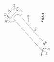 Fig. 99 - Vertebral joint implants and delivery tools