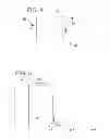 Fig. 03 - Shockwave catheter system with energy control