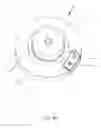 Fig. 06 - Method and system for destroying of undesirable formations in mammalian body