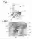 Fig. 02 - Battlefield defibrillation system