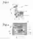 Fig. 03 - Battlefield defibrillation system