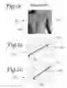 Fig. 08 - Battlefield defibrillation system
