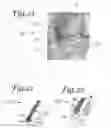 Fig. 09 - Battlefield defibrillation system