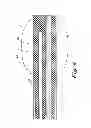 Fig. 06 - Method of implanting a spinal cord stimulator lead having multiple obstruction-clearing features