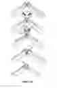 Fig. 08 - Electrode Assembly for an Active Implantable Medical Device