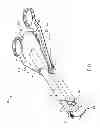 Fig. 02 - REPLACEABLE TIP SUTURING DEVICES, SYSTEM, AND METHODS FOR USE WITH DIFFERING NEEDLES