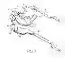 Fig. 04 - REPLACEABLE TIP SUTURING DEVICES, SYSTEM, AND METHODS FOR USE WITH DIFFERING NEEDLES