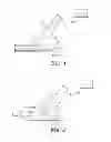 Fig. 02 - Apparatus and methods for internal surgical procedures