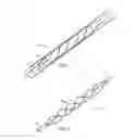 Fig. 02 - Apparatus and methods for treating hardened vascular lesions