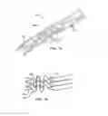 Fig. 09 - Apparatus and methods for treating hardened vascular lesions