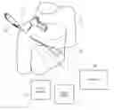 Fig. 01 - Methods and apparatus having bowstring-like staple delivery to a target tissue