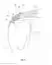 Fig. 04 - Methods and apparatus having bowstring-like staple delivery to a target tissue