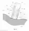 Fig. 10 - Methods and apparatus having bowstring-like staple delivery to a target tissue