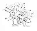 Fig. 01 - Anchor/suture used for medical procedures