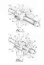 Fig. 02 - Anchor/suture used for medical procedures
