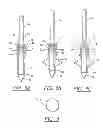 Fig. 04 - Anchor/suture used for medical procedures