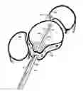 Fig. 01 - Methods for Anchoring Suture and Approximating Tissue