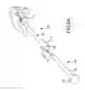 Fig. 07 - Vertebral joint implants and delivery tools