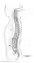 Fig. 02 - Odontoid fracture dynamic compression apparatus and method