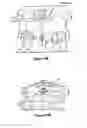 Fig. 09 - Odontoid fracture dynamic compression apparatus and method