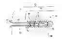 Fig. 01 - Bone implant and systems that controllably releases silver