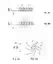 Fig. 06 - Bone implant and systems that controllably releases silver