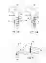 Fig. 09 - Bone implant and systems that controllably releases silver