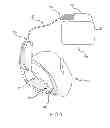 Fig. 02 - SYSTEMS AND METHODS FOR PLACING ELECTRONIC DEVICES INTO 