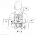 Fig. 07 - Coordinated resuscitation perfusion support