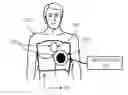 Fig. 01 - Coordinated resuscitation perfusion support