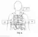 Fig. 09 - Coordinated resuscitation perfusion support
