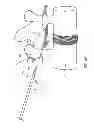 Fig. 07 - Systems and methods for implanting electrode leads for use with implantable neuromuscular electrical stimulator