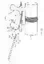 Fig. 09 - Systems and methods for implanting electrode leads for use with implantable neuromuscular electrical stimulator