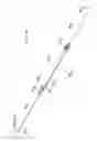 Fig. 35 - System for implanting a prosthesis