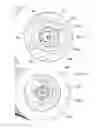 Fig. 49 - System for implanting a prosthesis