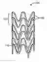 Fig. 01 - METHOD TO MINIMIZE CHAIN SCISSION AND MONOMER GENERATION IN PROCESSING OF POLY(L-LACTIDE) STENT