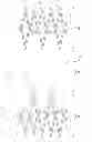 Fig. 01 - Triple-collar stent-graft