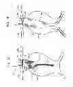 Fig. 07 - Triple-collar stent-graft