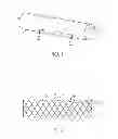 Fig. 02 - Radiopaque compositions, stents and methods of preparation