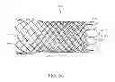 Fig. 04 - Radiopaque compositions, stents and methods of preparation