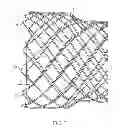 Fig. 06 - Radiopaque compositions, stents and methods of preparation