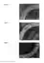 Fig. 02 - Medical device