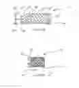 Fig. 02 - Low-profile prosthetic valve structure