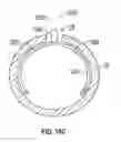 Fig. 75 - SYSTEMS AND METHODS FOR IMPROVED VESSEL ACCESS CLOSURE