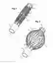 Fig. 02 - Implant for stabilizing vertebrae or bones