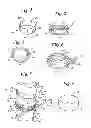 Fig. 02 - ANNULUS-REINFORCING BAND