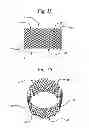 Fig. 05 - ANNULUS-REINFORCING BAND