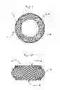 Fig. 06 - ANNULUS-REINFORCING BAND