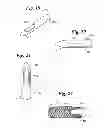 Fig. 07 - ANNULUS-REINFORCING BAND