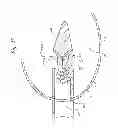 Fig. 08 - ANNULUS-REINFORCING BAND
